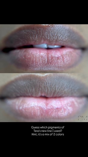 Dark Lip Neutralization ; bottom lip only. Tesstattoo She knew exactly how she wanted her gradient, so after a thorough consult I mapped out the precise areas we’ll continue brightening in sessions 2 and 3. Session 1 was done elsewhere (beautifully done), and dark lip work has to be approached slowly to prevent PIH which is why this process takes more sessions than a standard lip blush. Session 3 is where we’ll add that bubblegum-drop pop and tie the entire blend together. | Bella Faccia Permane