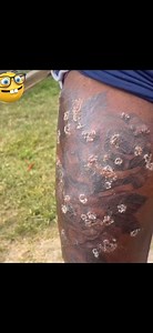 Y’all Gotta Be Careful Who Your Getting To Do Your Tattoo! #newfearunlocked #tattoogonewrong #wtf | Raw Unfiltered