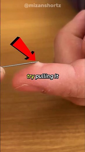 Secret Method To Remove A Splinter 😱