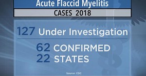 Spike in cases of polio-like illness