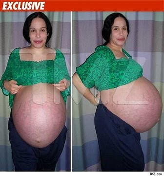 Octo-Mom's Pregnant Stomach (Pictures)