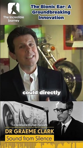 Unlocking the Future of Hearing: The Bionic Ear Revolution!
