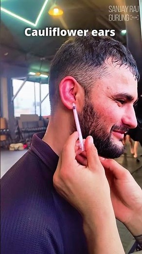 how to treat cauliflower ears ✨🔥