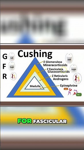 Cushing Syndrome Adrenal adenoma