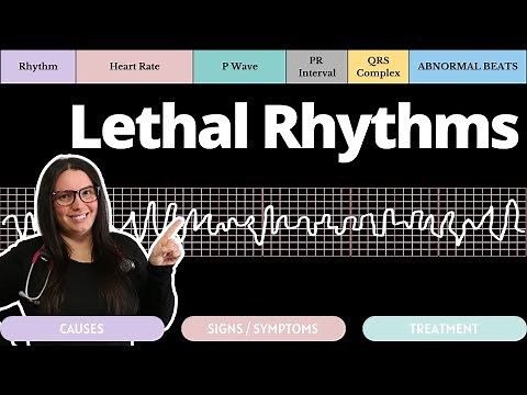 Lethal Rhythms on an EKG with Qs | Circulatory System and Disease | NCLEX-RN | Nurse Cheung