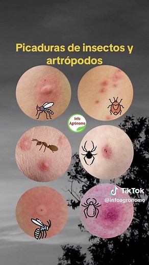 Picaduras de insectos y artrópodos: Tipos, síntomas y tratamientos