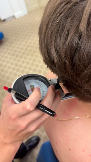 Why we use Instrumentation in the Gonstead System: The Gonstead nervoscope measures heat differences along the spine, helping us pinpoint areas of potential nerve irritation. When the spine is injured, the surrounding tissues often become inflamed — and inflammation raises skin temperature. By detecting these small temperature changes, the nervoscope gives us a level of specificity our hands alone can’t always catch. It also allows us to track progress from visit to visit with objective, consist