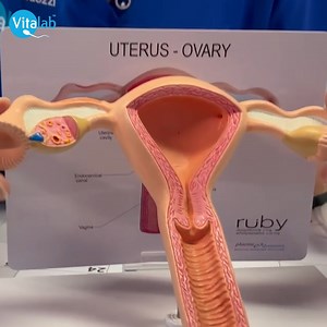 Understanding Conception & Implantation 🍼 𝗣𝗿𝗲𝗴𝗻𝗮𝗻𝗰𝘆 𝗔𝘄𝗮𝗿𝗲𝗻𝗲𝘀𝘀 𝗪𝗲𝗲𝗸 🍼 Have you ever wondered what happens inside your body after conception? 🤔 Dr. Deanna Guidozzi breaks it down in this video! From the moment the sperm meets the egg to the journey of fertilization and implantation, she explains how early pregnancy begins. 🌱 Stay tuned for more insights throughout the week! 💕 #PregnancyAwarenessWeek #Vitalab #FertilityJourney 🎥 Watch the full video www.vitalab.com | Vit