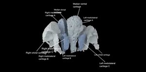 PREHISTORIC FISH FILLS 100 MILLION YEAR GAP IN EVOLUTION OF THE SKULL