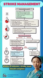 2.7K views · 22 reactions | 易 “Be a Stroke Hero! Learn exactly what to do in those critical first moments—your quick action can save a life. Watch now and master stroke management!” ✨ #StrokeSmart #TimeIsBrain #StrokeManagement #everyone #fyp #nursingreferencecards | Nursing Reference Cards | Facebook