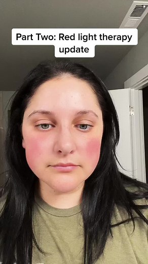Dr. Dennis Gross Faceware Pro LED Mask Review