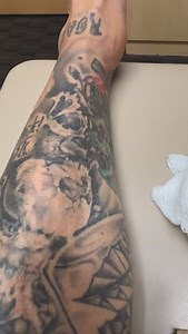 Think we got it right this time! 🙌🏼🛹 • • • #recovery #surgery #skatelife #partofthegame #shecks #ryansheckler #reels #reelsinstagram #skateboardingisfun | Ryan Sheckler