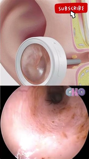 Otoscope || Ear #shortvideo