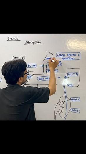 2.2K reactions · 289 shares | Diabetes pathophysiology #diabetes #diabetespathophysiology | Mujahid Khan | Facebook