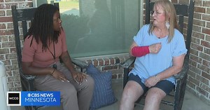 Texas woman attacked by hawk and snake at the same time