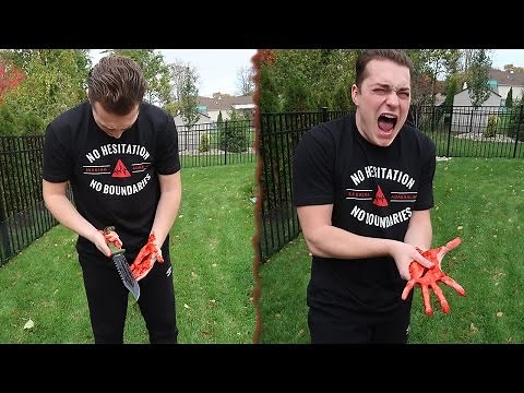 I SLICED MY HAND OPEN!