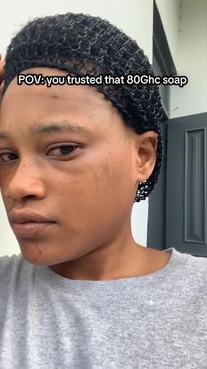 Achieve Glowing Skin with Effective Soap Treatments