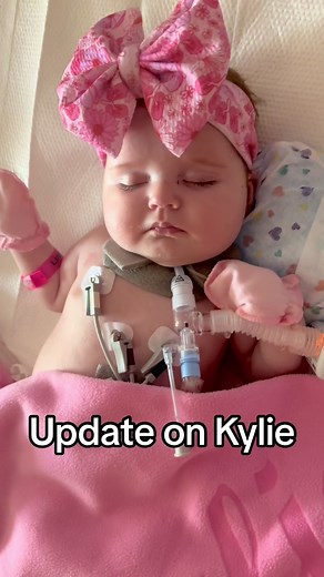 Update on Kylie: PLEASE pray for me and Kylie’s dad today. We have a big decision to make and I am anxious and sick to my stomach over it. I need God’s guidance more than ever. 🙏🏼 Kylie is not doing well. Today she has a high fever and she is still throwing up even causing her trach/ ventilator to come out. 💔 Her ventilator settings are still high, which may be causing her to throw up more from the pressure. Her FIO2 requirements are 75-100. 💔 She is requiring more sedation and pain medicati