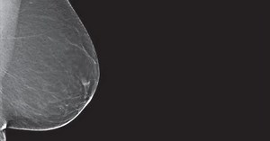 1M views · 16K reactions | Nearly half of women over 40 have dense breasts, and yet conventional mammograms have difficulty detecting cancer through the fibrous breast tissue. The Genius™ 3D mammography™ exam is a more accurate exam for these women. | Hologic 3D Mammogram | Facebook