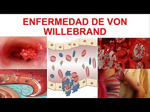 ENFERMEDAD DE VON WILLEBRAND