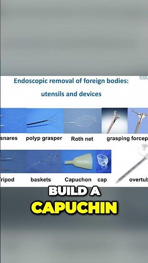 Endoscopic removal of foreign bodies: utensils and devices