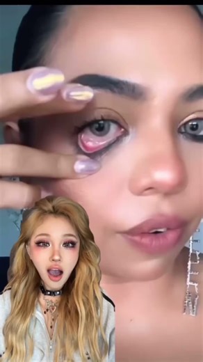 Tips for Removing Contact Lenses Easily