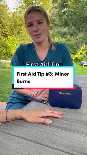 Effective Burn Care: Tips and Tricks for Treating Minor Burns