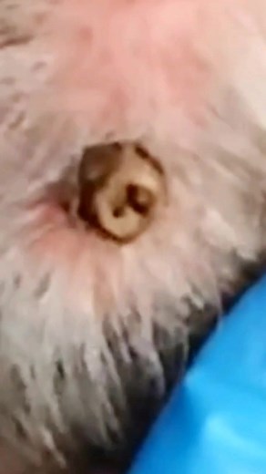 💥🤩 Dr. Sarisfaction 🤩💥 Watch Me Pop The Biggest Blackheads and Pimples Ever 🎥 🚀✨ You Won’t Believe The Results 😱 Like, Comment and Share If You Enjoyed This Video 💖 Follow Me For More Amazing Extractions 🔥 #skincare #beauty #tiktokviral #pimplepopping #blackheadremoval #whiteheadremoval #zits #acne #skin #skincare #selfcare #satisfying #asmr #pimple #pimples #acneremoval #cyst #blackhead #whitehead #blemish #zit #rosacea #eczema #psoriasis #skincareroutine #skincaretips #skincareaddict