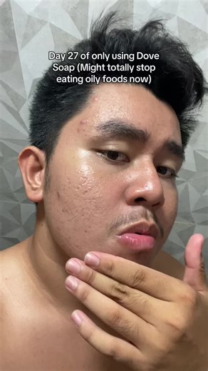 Day 27: Transforming My Skin with Dove Soap