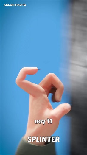 Splinter Pain Explained 😖