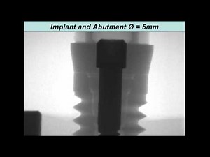 Zipprich Micro Movements on Implant Abutment Interfaces part 1