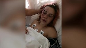 Pregnant ‘Pokemon Go’ player hit by car, given emergency C-section to save baby