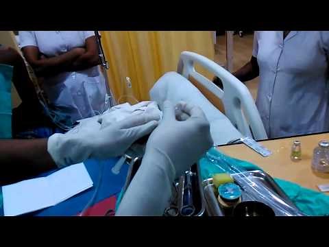 Chest Drain by Pig-Tail Catheter