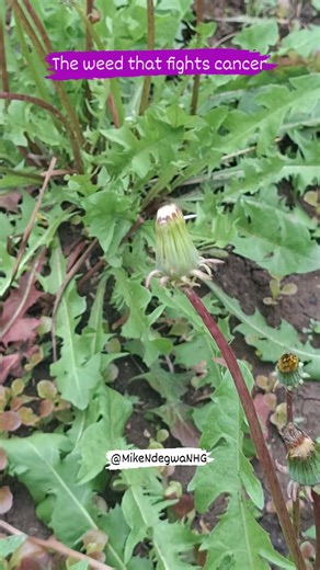 While most people pull it out of their gardens, healers have used dandelion root for centuries to do what modern medicine only recently confirmed — 💥 trigger apoptosis (cell death) in cancer cells while protecting the healthy ones. That’s right — studies show dandelion root extract can slow the growth of leukemia, breast, colon, and prostate cancer cells... naturally. But here’s the real secret: It doesn’t just fight disease — it restores the terrain: 🌱 Cleanses the liver 💧 Improves digestion