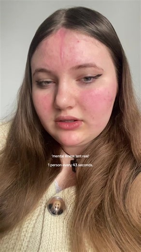 Supporting Mental Health Recovery