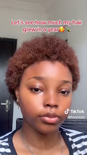 Year Update: 4C Hair Growth Transformation