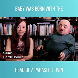 4K views · 75 reactions | Explore the incredible lives of remarkable individuals, from a courageous Indian child with a rare deformity to a resilient man with brittle bone disease who defies limitations. #BodyBizarre Watch full episodes on discovery+: https://bit.ly/3HfHr6e | Love Science | Facebook