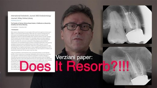 Bioactivity vs Stability in Endodontic Sealers: are We Overcorrecting? | Allen Ali Nasseh DDS. MMSc.