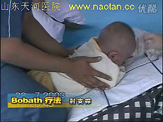 bobath疗法主要手技