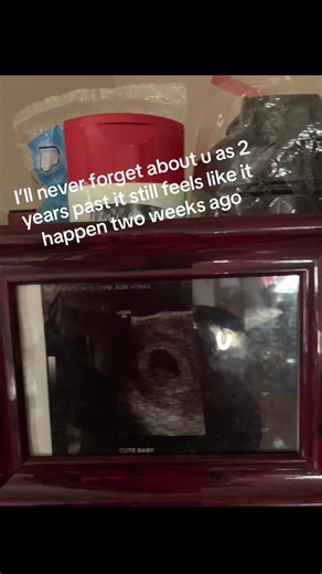 #greenscreen #stillborn #2ndtrimstermisscarge I was always scared to die now I really don’t has anyone felt that after greif