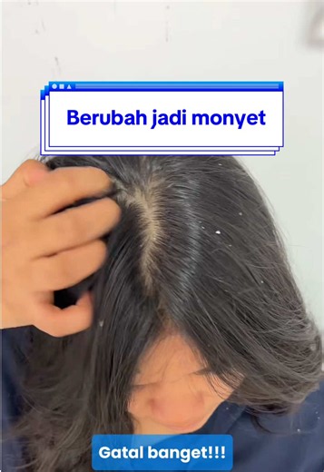 CBD Cica Vit Scalp Revive Cleansing Scrub untuk Kulit Kepala Gatal