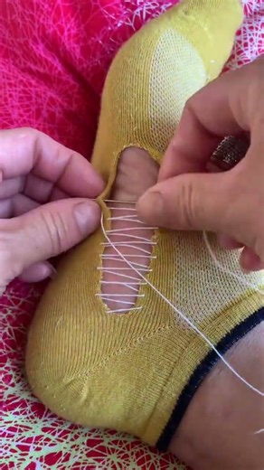 How to Darn a Sock Seamlessly | DIY Clothes Repair #socks #shorts #socksrepair