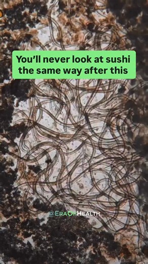 Think your sushi is safe? Think again. Up to 90% of wild-caught fish test positive for parasites like Anisakis - and even farmed fish aren’t far behind. Here’s why it matters: These worms can survive in raw or undercooked fish. They burrow into your gut wall, triggering: → Sudden food allergies → Bloating & stomach pain that never go away → Autoimmune-like symptoms that confuse doctors Cooking kills them instantly. Sushi might look harmless, but parasites don’t care about presentation. Sometimes