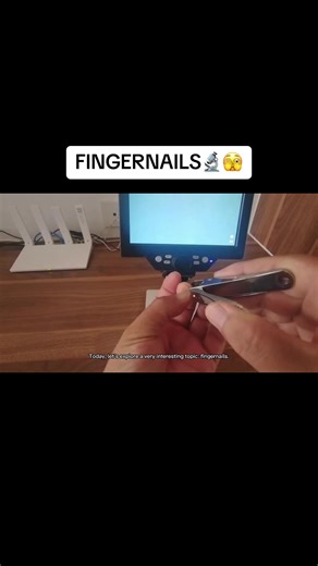 Discover the Secrets of Fingernails Under the Microscope
