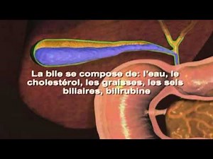 Calculs biliaires Symptômes Définition Diagnostic Traitements