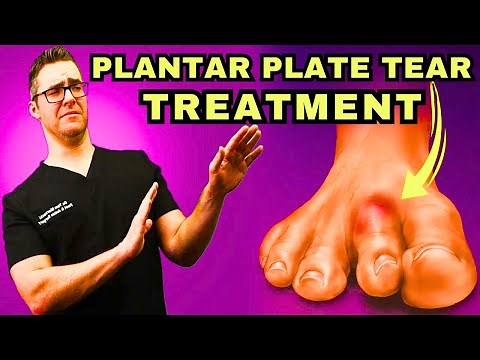 Second Toe PAIN & Plantar Plate Tear INJURY [Taping & BEST Treatment!]