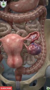 The Ovary Twisted on Itself?! 😱 | Ovarian Torsion Explained