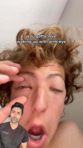 30K views · 39 reactions | Waking up with swollen eyelids, redness, and yellow crusting? That’s a classic sign of conjunctivitis. It’s caused by an infection of the thin membrane over the eye and eyelid, and the discharge can make it hard to open your eyes in the morning. It’s highly contagious but usually clears with antibiotic drops. Have you experienced this? VC: @eggworthjenkins #medical #health #healthtips #pinkeye #conjunctivitis | Kunal Sood, MD | Facebook