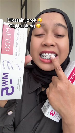 MW 5 untuk Gigi Kuning: Cara Cepat Biar Percaya Diri
