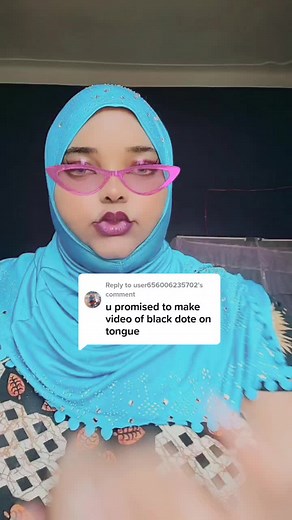Understanding Black Dots on the Tongue: Causes & Remedies